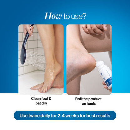 20% Urea Foot Roll On - 50 ml (Buy 1 Get 1 Free 🔥)