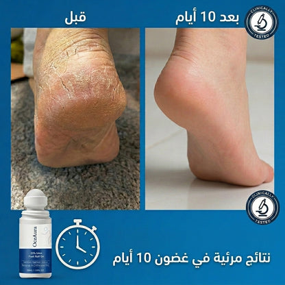 رول العناية بالأقدام يوريا 20% - 50 مل (اشتري 1 واحصل على 1 مجاناً 🔥)